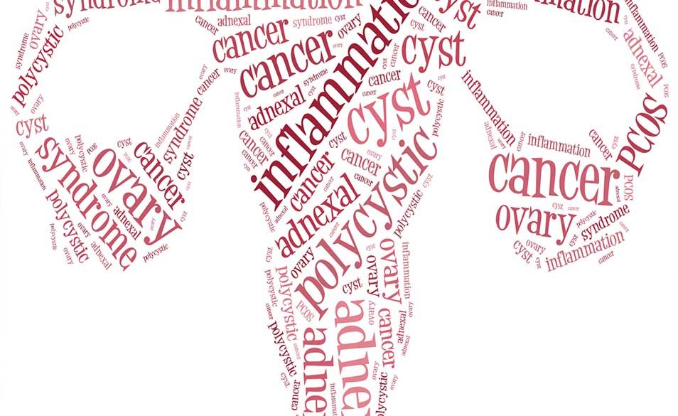 Why all Women Should Know About Polycystic Ovaries Syndrome ?