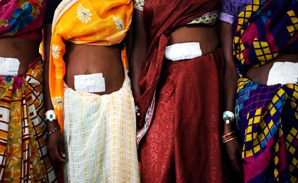 Is India ready to change it’s decades old reliance of female sterilization?